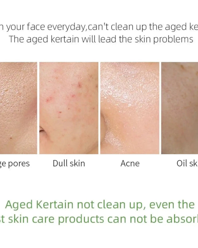 Skincare product advertisement showing different skin conditions and text about cleaning the face.