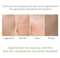 Skincare product advertisement showing different skin conditions and text about cleaning the face.